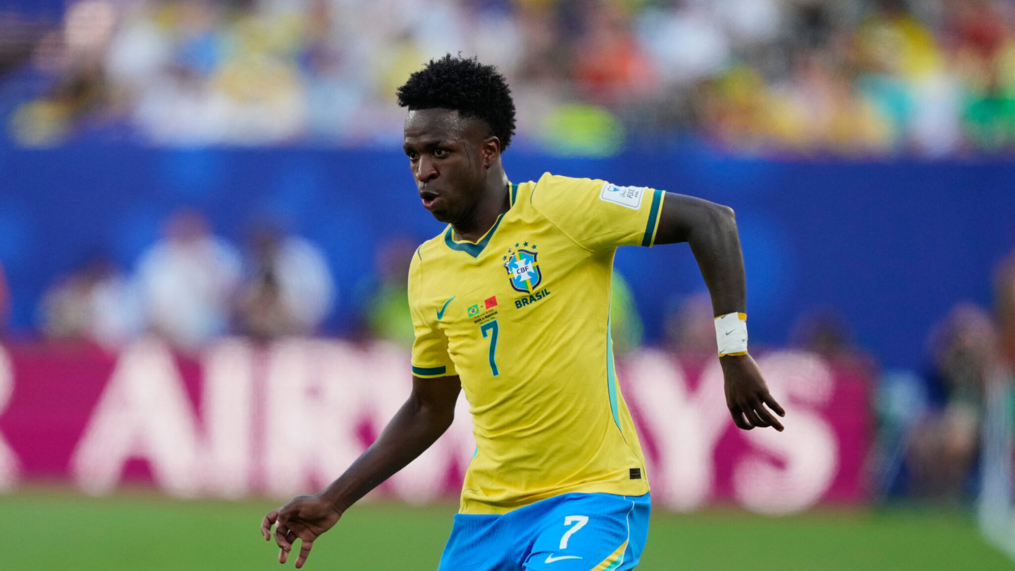 Vinícius: Unrecognizable After Cosmetic Surgery on His Chin (PHOTO)
