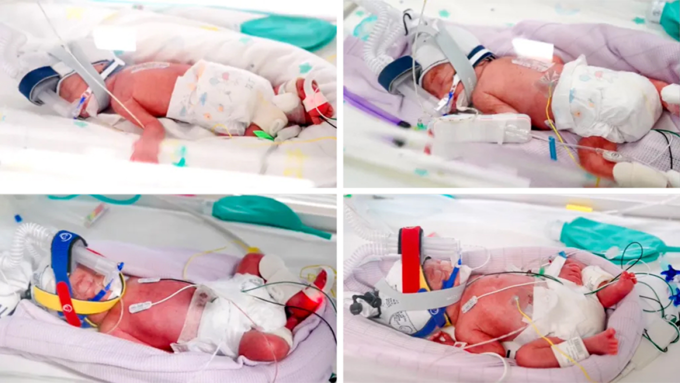 A one-in-15-million chance: An Australian woman gave birth to identical quadruplets who were delivered naturally