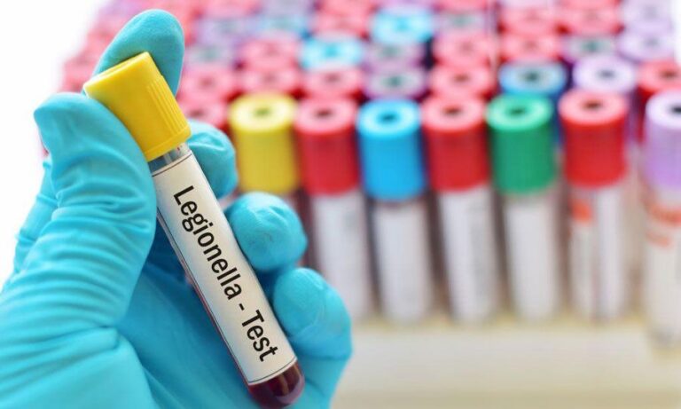 What is legionnaires’ disease and how is it spread?